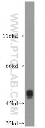 XIAP Antibody in Western Blot (WB)