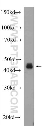 XIAP Antibody in Western Blot (WB)