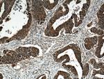 GRB7 Antibody in Immunohistochemistry (Paraffin) (IHC (P))