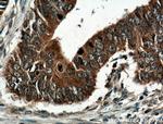 GRB7 Antibody in Immunohistochemistry (Paraffin) (IHC (P))