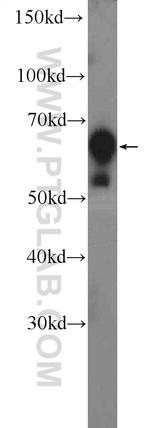 GRB7 Antibody in Western Blot (WB)