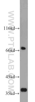 GRB7 Antibody in Western Blot (WB)