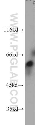 GRB7 Antibody in Western Blot (WB)