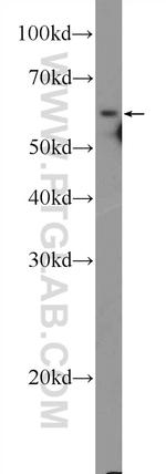 GRB7 Antibody in Western Blot (WB)