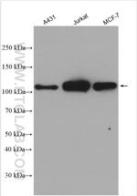 RB1 Antibody in Western Blot (WB)