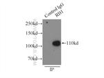 RB1 Antibody in Immunoprecipitation (IP)