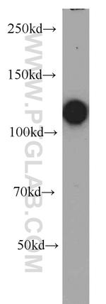 RB1 Antibody in Western Blot (WB)