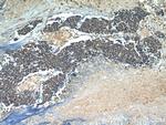 RB1 Antibody in Immunohistochemistry (Paraffin) (IHC (P))