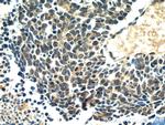 RB1 Antibody in Immunohistochemistry (Paraffin) (IHC (P))