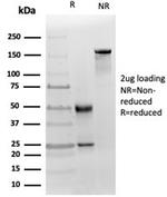 MICA Antibody in SDS-PAGE (SDS-PAGE)