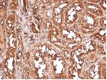 MICA Antibody in Immunohistochemistry (Paraffin) (IHC (P))