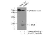 SNAPIN Antibody in Immunoprecipitation (IP)