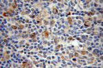 MEF2C Antibody in Immunohistochemistry (Paraffin) (IHC (P))