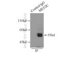 MEF2C Antibody in Immunoprecipitation (IP)