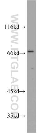 MEF2C Antibody in Western Blot (WB)