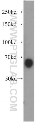 MEF2C Antibody in Western Blot (WB)