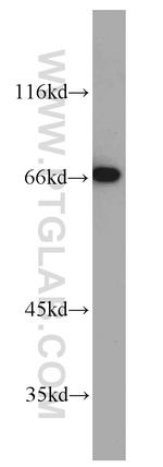 MEF2C Antibody in Western Blot (WB)