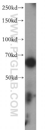 MEF2C Antibody in Western Blot (WB)