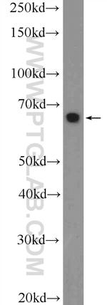 MEF2C Antibody in Western Blot (WB)