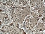 FKBPL Antibody in Immunohistochemistry (Paraffin) (IHC (P))