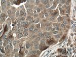 FKBPL Antibody in Immunohistochemistry (Paraffin) (IHC (P))