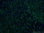 Notch1 Antibody in Immunohistochemistry (Paraffin) (IHC (P))