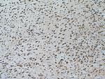 Notch1 Antibody in Immunohistochemistry (Paraffin) (IHC (P))