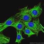 beta Tubulin Antibody in Immunocytochemistry (ICC/IF)