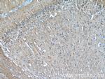 beta Tubulin Antibody in Immunohistochemistry (Paraffin) (IHC (P))