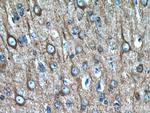 beta Tubulin Antibody in Immunohistochemistry (Paraffin) (IHC (P))