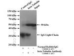 beta Tubulin Antibody in Immunoprecipitation (IP)