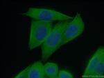 beta Tubulin Antibody in Immunocytochemistry (ICC/IF)