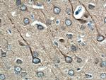 beta Tubulin Antibody in Immunohistochemistry (Paraffin) (IHC (P))