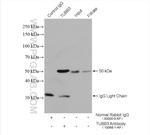 beta Tubulin Antibody in Immunoprecipitation (IP)