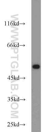 beta Tubulin Antibody in Western Blot (WB)