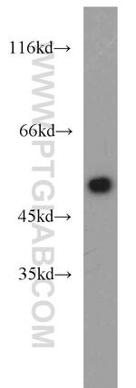 beta Tubulin Antibody in Western Blot (WB)