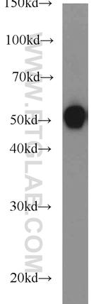 beta Tubulin Antibody in Western Blot (WB)
