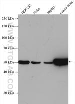 beta Tubulin Antibody in Western Blot (WB)