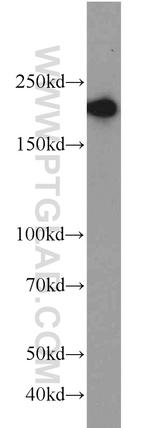 RB1CC1 Antibody in Western Blot (WB)