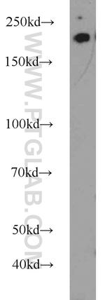 RB1CC1 Antibody in Western Blot (WB)