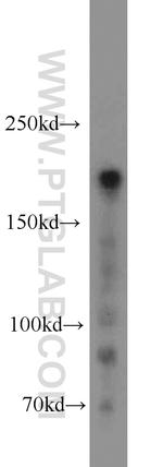 RB1CC1 Antibody in Western Blot (WB)