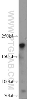 RB1CC1 Antibody in Western Blot (WB)