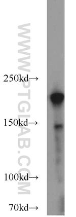 RB1CC1 Antibody in Western Blot (WB)