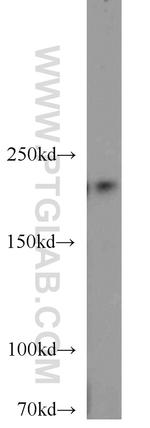 RB1CC1 Antibody in Western Blot (WB)