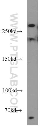 RB1CC1 Antibody in Western Blot (WB)