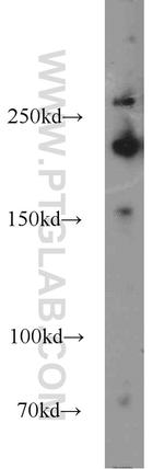 RB1CC1 Antibody in Western Blot (WB)