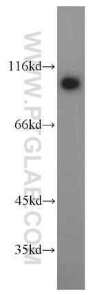 ELAC2 Antibody in Western Blot (WB)