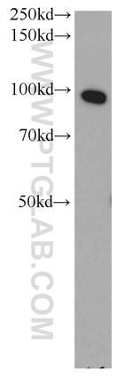 ELAC2 Antibody in Western Blot (WB)