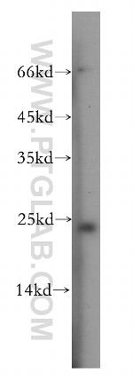 Recoverin Antibody in Western Blot (WB)