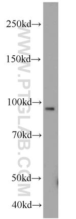 Importin beta Antibody in Western Blot (WB)